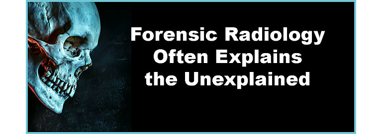 Forensic Radiology Often Explains the Unexplained
