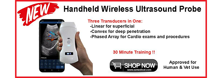  Revolutionizing Medical Imaging: The SX-1CTS Handheld Wireless Ultrasound Probe with Three Transducers in One