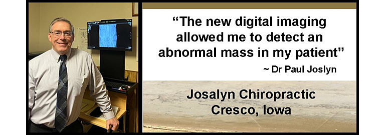 “The new digital imaging allowed me to detect an abnormal mass in my patient”