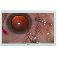 Surgical Display Monitors