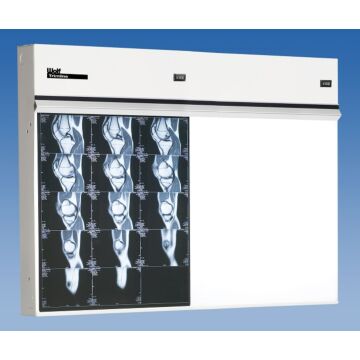 Trimline Double Bank X-Ray Illuminator