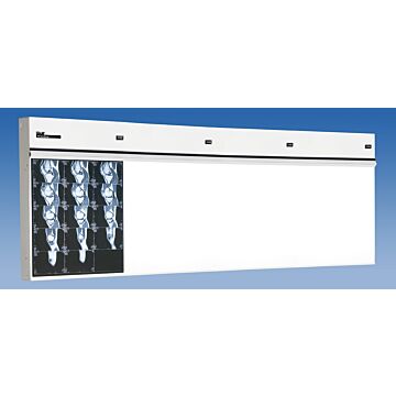 Trimline Four Bank X-Ray Illuminator