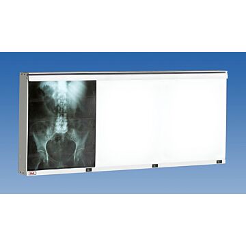 Econoline Three Bank X-Ray Illuminator