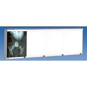Econoline Four Bank X-Ray Illuminator