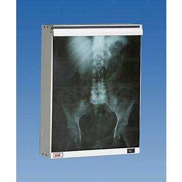 Econoline Single Bank X-Ray Illuminator