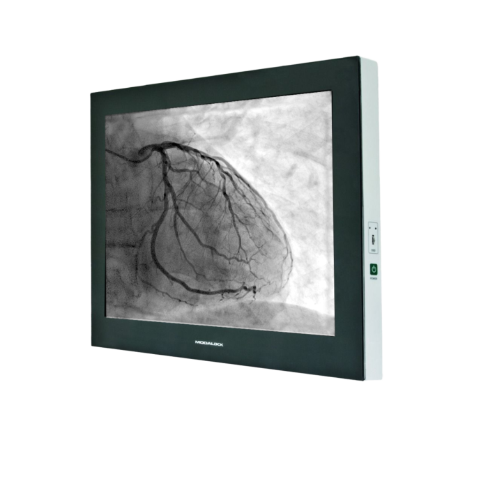 Modalixx G202MP Grayscale LCD