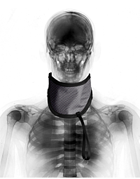 Standard Thyroid Collar - TSS