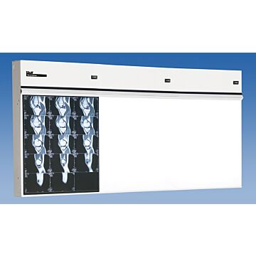 Trimline Three Bank X-Ray Illuminator