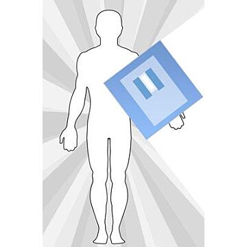 SecureShield for Dialysis