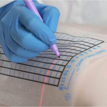 Fast Find Grid for CT Biopsies | Disposable CT-Guided Needle Localization Grid