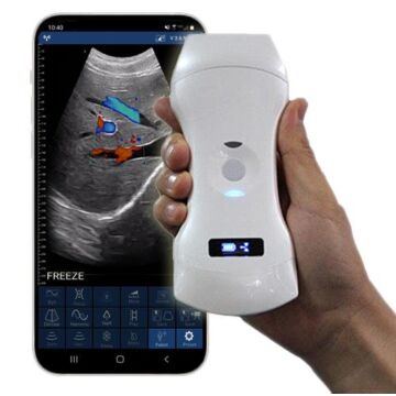 3-in-1 Handheld Wireless Ultrasound