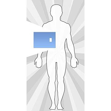 SecureShield Multipurpose with Fenestration