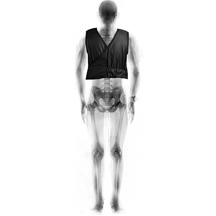 Frontal Apron with Hook & Loop Shoulder Closure