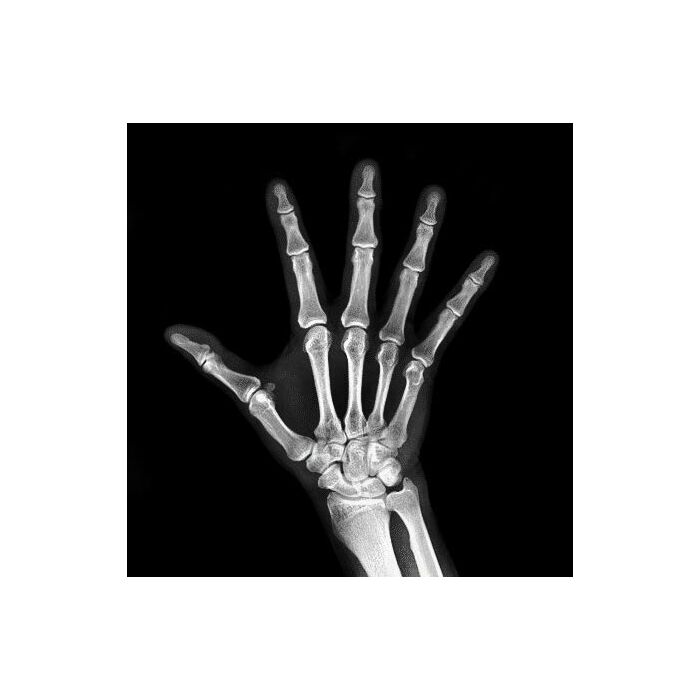 Europa Portable X-Ray System