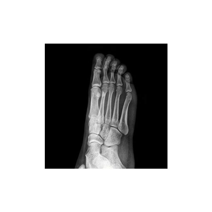 Europa Portable X-Ray System