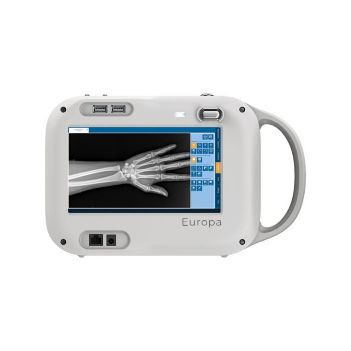 Europa Portable X-Ray System