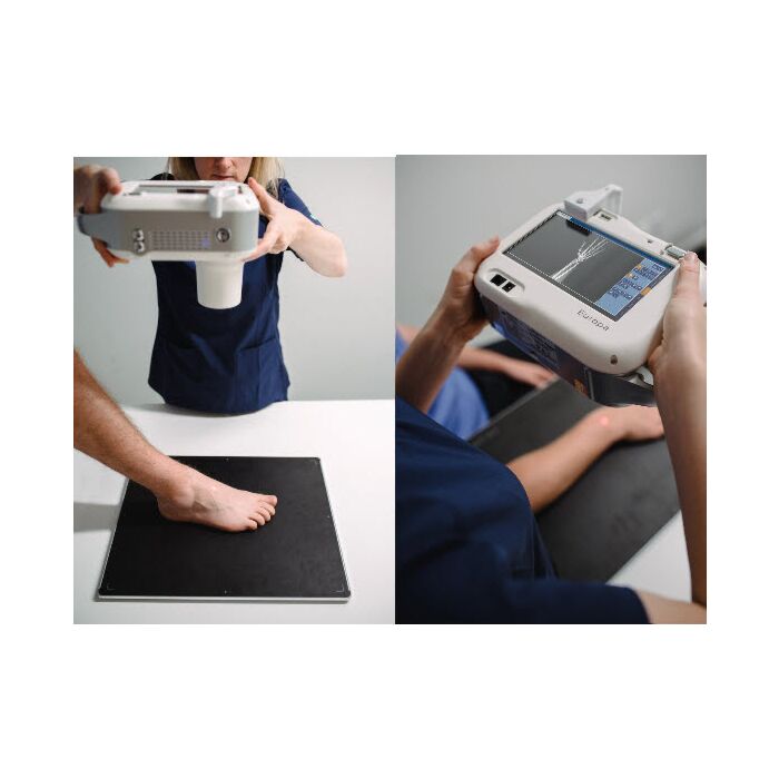 Europa Portable X-Ray System