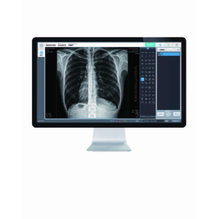 Europa Portable X-Ray System