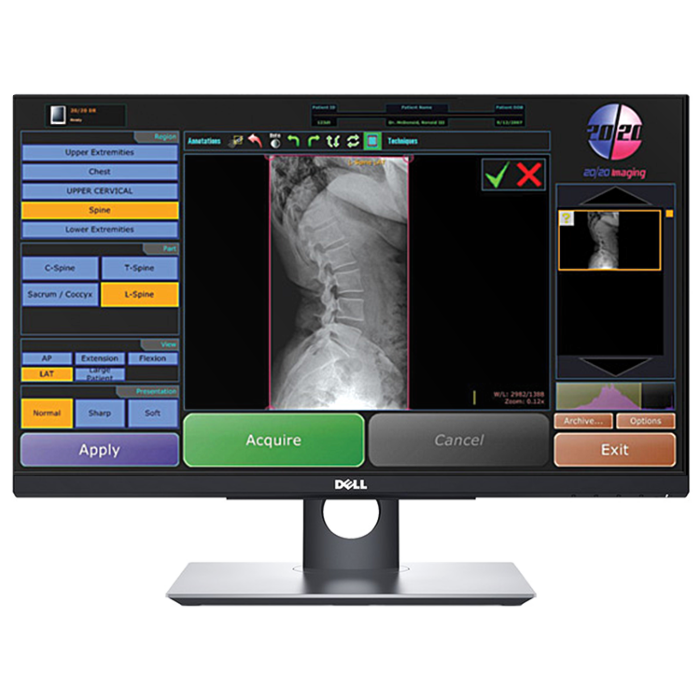 20/20 CFPW Wireless 14X17 Chiropractic Direct Digital Imaging System - DR PANEL