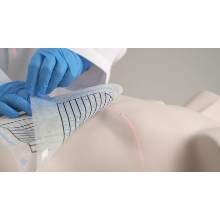 Fast Find Grid for CT Biopsies