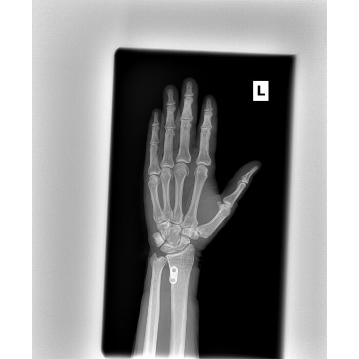 UC-5000 Digital Image Package, Portable X-Ray & Wireless Digital DR