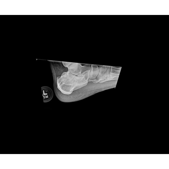 UC-5000 Digital Image Package, Portable X-Ray & Wireless Digital DR