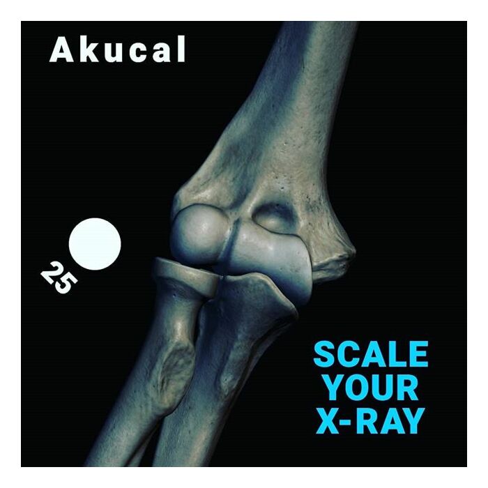 Akucal EVO Image Scaling Device