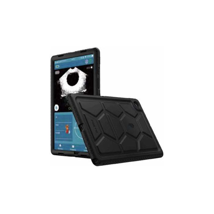 Peaksonic M4 Bladder Scanner
