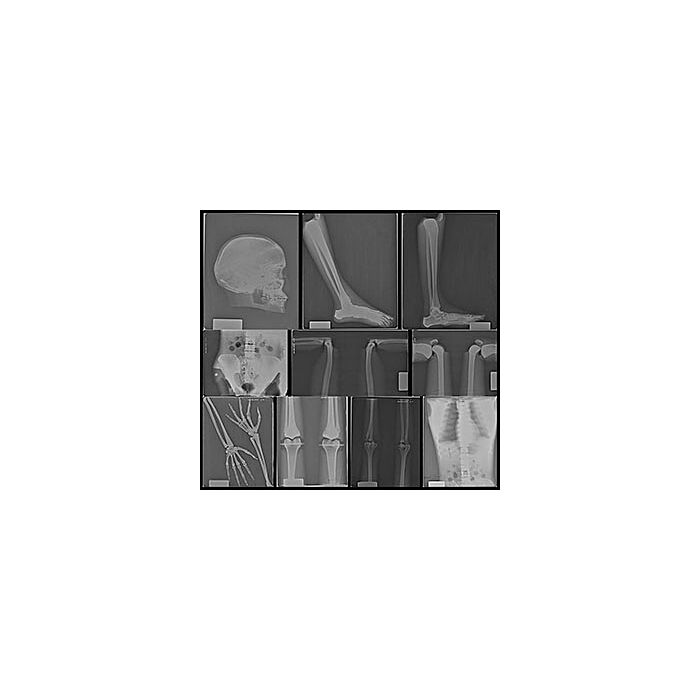 TAKE-APART PIXY Teaching Whole Body Phantom