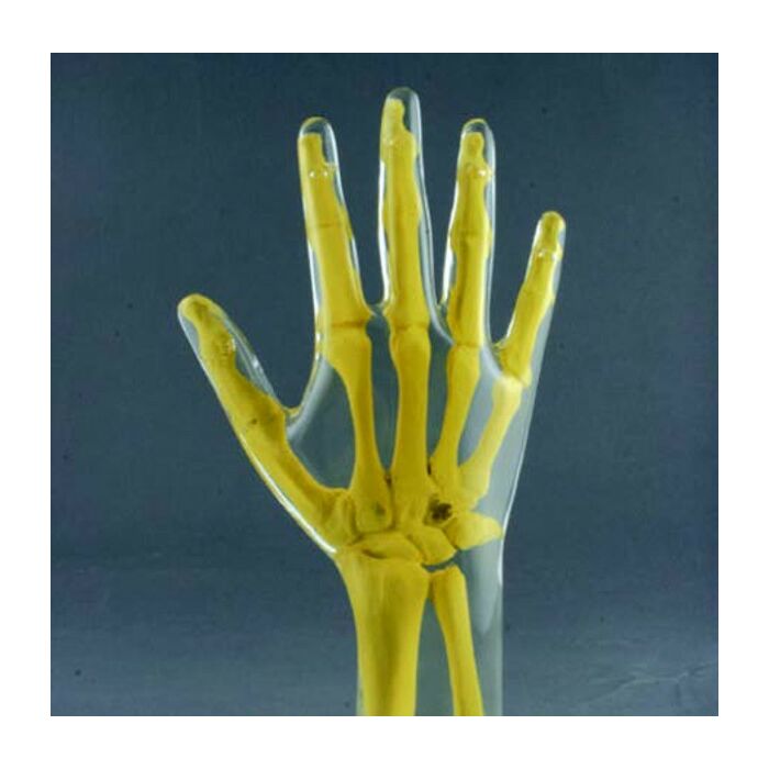 Hand and Wrist AP/PA Phantom