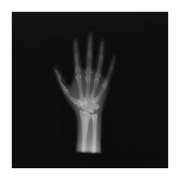 Hand and Wrist AP/PA Phantom