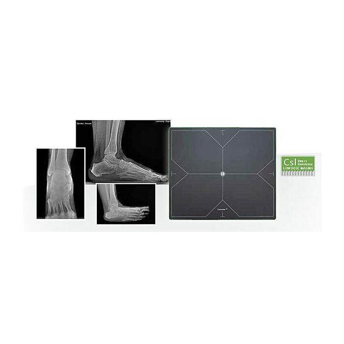 Tiger DR Podiatry Digital Detector & TigerView Software