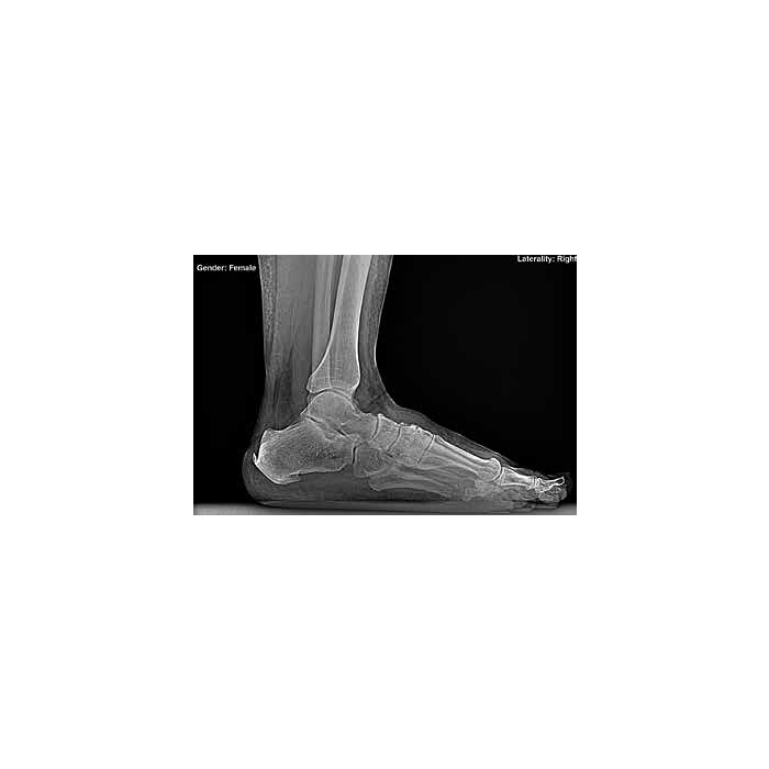 Tiger DR Podiatry Digital Detector & TigerView Software