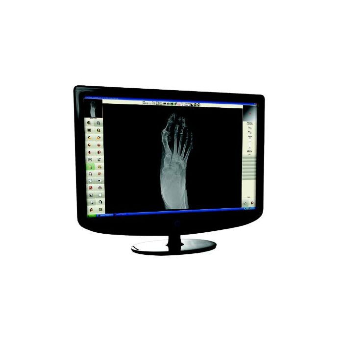 Tiger DR Podiatry Digital Detector & TigerView Software