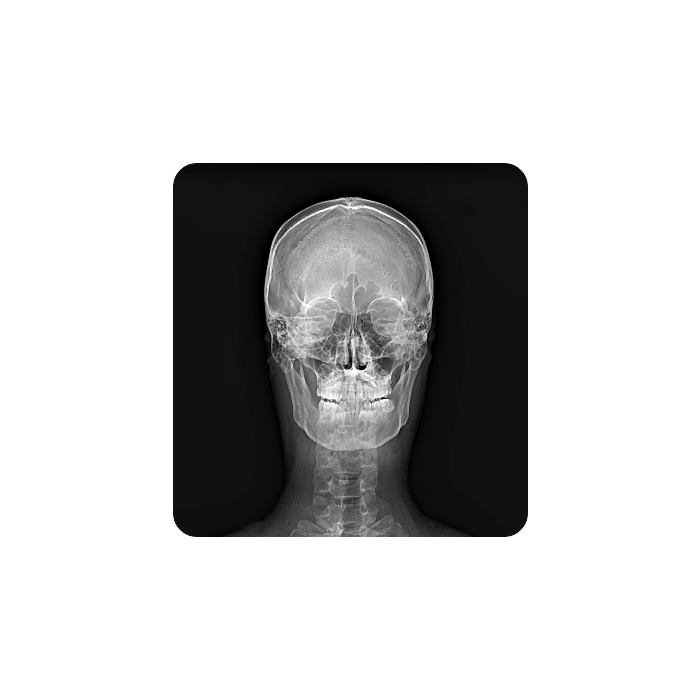 OTOM Portable Handheld X-Ray