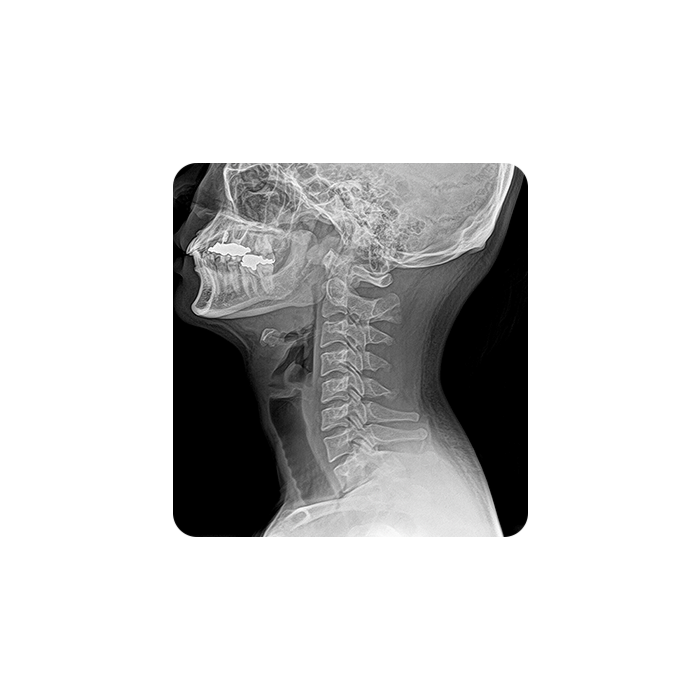 OTOM Portable Handheld X-Ray