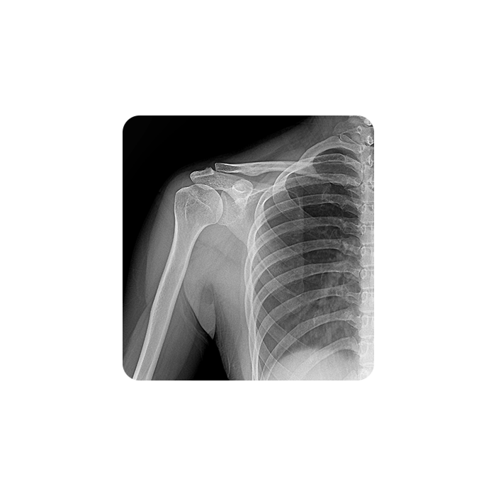 OTOM Portable Handheld X-Ray