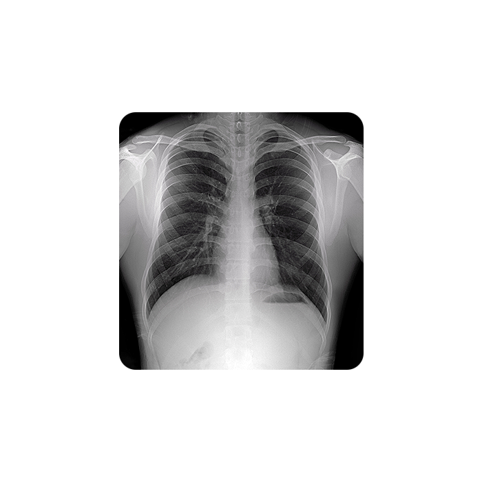 OTOM Portable Handheld X-Ray