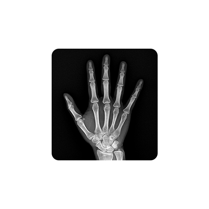 OTOM Portable Handheld X-Ray