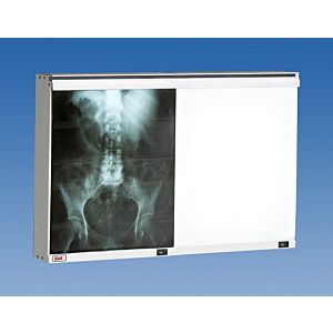 Econoline Double Bank X-Ray Illuminator
