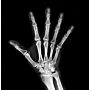 Europa Portable X-Ray System