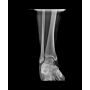 UC-5000 Digital Image Package, Portable X-Ray & Wireless Digital DR