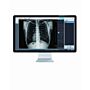 Europa Portable X-Ray System