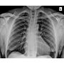UC-5000 Digital Image Package, Portable X-Ray & Wireless Digital DR