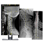 20/20 CFPW Wireless 14X17 Chiropractic Direct Digital Imaging System - DR PANEL