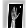 UC-5000 Digital Image Package, Portable X-Ray & Wireless Digital DR