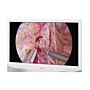 LMD-32M1MD Sony Surgical Monitor w/VESA DISPLAY HDR 1000 certification