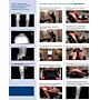 Knee Arthroplasty Stress Assembly Set