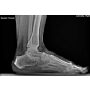 Tiger DR Podiatry Digital Detector & TigerView Software