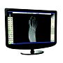 Tiger DR Podiatry Digital Detector & TigerView Software